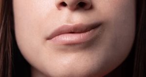 closeup-mouth-girl-hemiparesis-bells-260nw-2357574523 copy