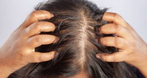 hair falling, head louse, hair care, frizzy, messy, blading scalp