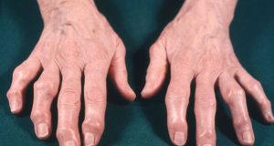 osteo-hands
